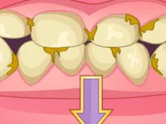 لعبة Bad Teeth Makeover على الانترنت