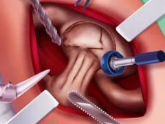 لعبة Princess Hips Surgery على الانترنت
