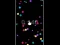 لعبة Pop Ball على الانترنت
