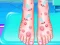 لعبة Emma Foot Treatment على الانترنت