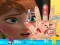 لعبة Anna hand doctor على الانترنت