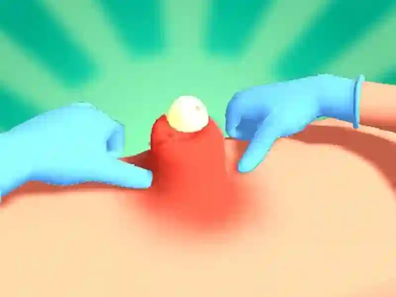 لعبة Pimple Squeeze على الانترنت