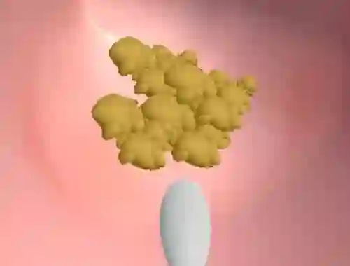 لعبة Earwax Clinic على الانترنت