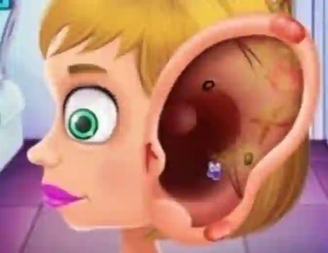 لعبة Children's Doctor Treating Ears على الانترنت