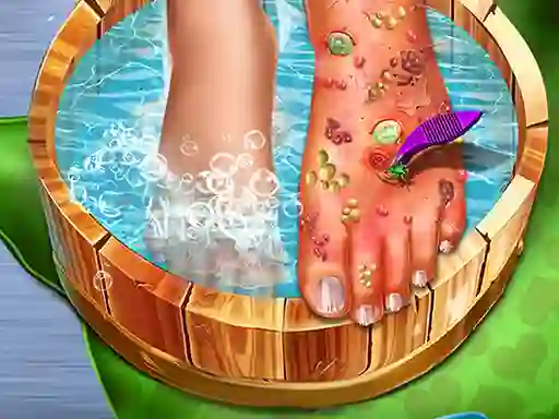 لعبة Feet Skin Doctor على الانترنت