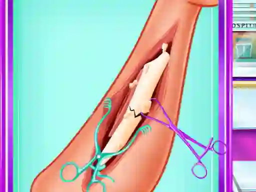 لعبة Ladybug Leg Surgery على الانترنت