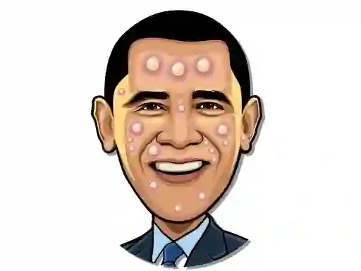 لعبة Celebrity Pimple Pop على الانترنت