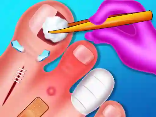 لعبة Funny Nail Doctor على الانترنت