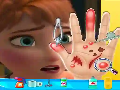 لعبة Anna hand doctor على الانترنت